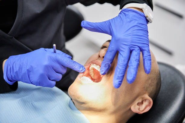 Best Emergency Gum Treatment in Bergenfield, NJ