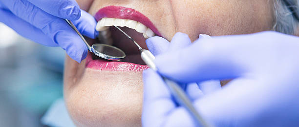Best Emergency Dental Care for Broken or Chipped Teeth in Bergenfield, NJ